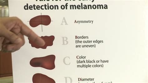 melanoma treatment centers excellence